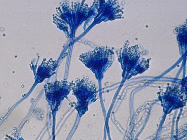 Aspergillus-Oryzae-la-mot-loai-nam-soi-co-mau-sac-tu-vang-den-nau.jpg