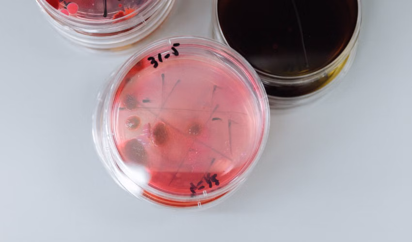 virus tru sau duoc nhan nuoi trong dieu kien phong thi nghiem truoc khi bao che